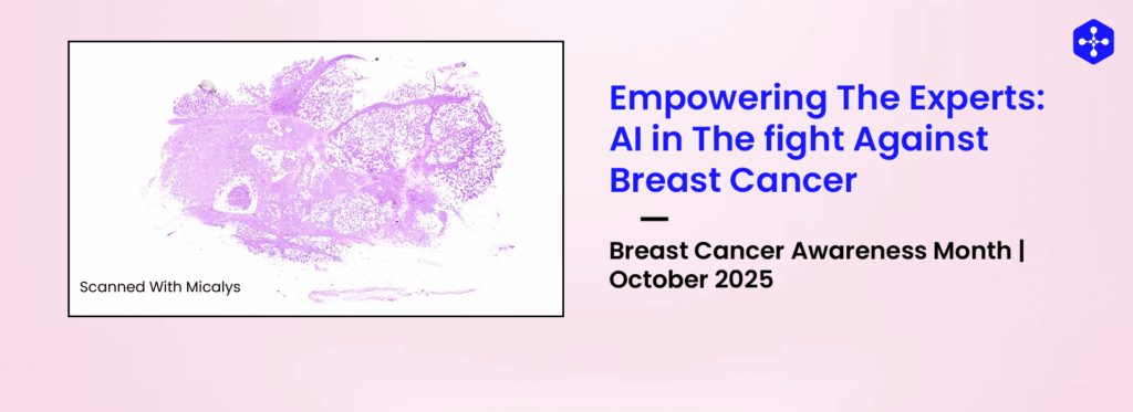 Breast Cancer wsi seen under micalys whole slide scanner